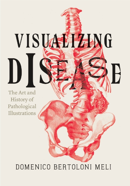 Visualizing Disease: The Art and History of Pathological Illustrations