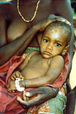 58. Malnourished child wearing a full cowry bracelet